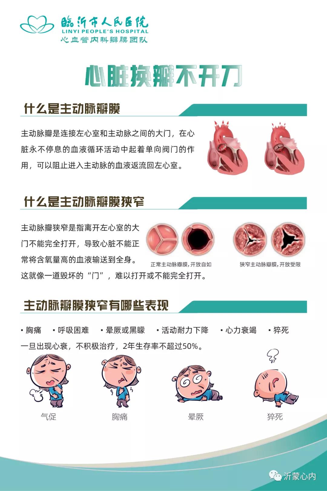 心脏换瓣不开刀---心血管内科瓣膜团队